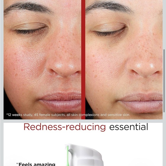 EltaMD UV Skin Recovery Broad Spectrum SPF 50 Red Color Correcting - Picture 4 of 9